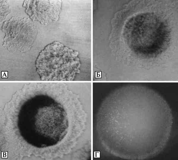 Макроскопические изображения колоний Y. pestis